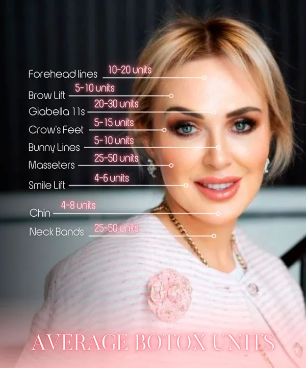 Average Botox units