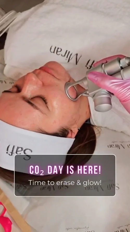 CO2 laser