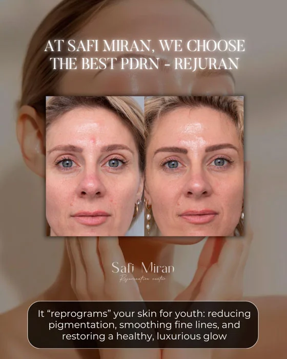 PDRN skincare before and after