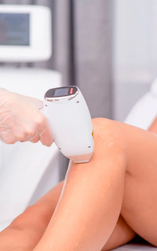 Laser hair removal