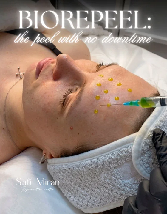 Biorepeel chemical peel