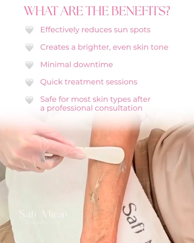 Benefits of hyperpigmentation treatment