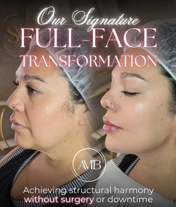Full-face transformation before and after without surgery