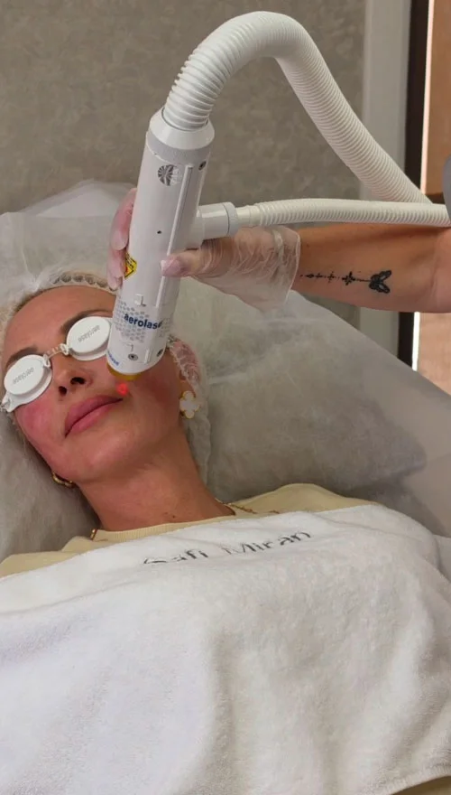 Melasma treatment in Denver, CO